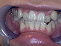 [adoa-0579] 真白わかなチャンの激レアな歯・口内・のどちんこ観察！のキャプチャ画像 6
