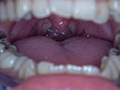 [adoa-0579] 真白わかなチャンの激レアな歯・口内・のどちんこ観察！のキャプチャ画像 7