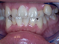 [adoa-0579] 真白わかなチャンの激レアな歯・口内・のどちんこ観察！のキャプチャ画像 8