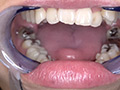 [adoa-0579] 真白わかなチャンの激レアな歯・口内・のどちんこ観察！のキャプチャ画像 10