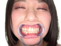 [adoa-0585] 新人AV女優 霜月まどかチャンのはじめての口内・歯観察のキャプチャ画像 2
