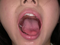 [adoa-0585] 新人AV女優 霜月まどかチャンのはじめての口内・歯観察のキャプチャ画像 3