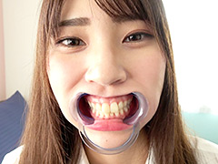 [adoa-0599] 竹内夏希チャンの歯・口内観察＆指フェラプレイ！のイメージ画像