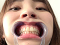 [adoa-0599] 竹内夏希チャンの歯・口内観察＆指フェラプレイ！のキャプチャ画像 2