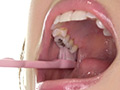 [adoa-0615] 宮沢ちはるチャンの超激レア歯・口内フェチ作品！のキャプチャ画像 5