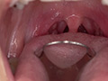 [adoa-0615] 宮沢ちはるチャンの超激レア歯・口内フェチ作品！のキャプチャ画像 9