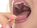 [adoa-0615] 宮沢ちはるチャンの超激レア歯・口内フェチ作品！のキャプチャ画像 10