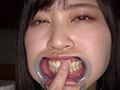 [adoa-0759] 望月あやかの超激レアの口内・歯・のどちんこ観察★のキャプチャ画像 7