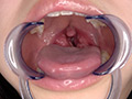 [adoa-0759] 望月あやかの超激レアの口内・歯・のどちんこ観察★のキャプチャ画像 9
