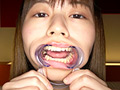 [adoa-0767] 園田かのこチャンの初めての歯・口内・舌ベロ唾観察