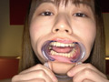 [adoa-0767] 園田かのこチャンの初めての歯・口内・舌ベロ唾観察のキャプチャ画像 2