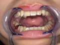 園田かのこチャンの初めての歯・口内・舌ベロ唾観察 サンプル画像3