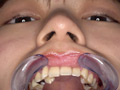 [adoa-0767] 園田かのこチャンの初めての歯・口内・舌ベロ唾観察のキャプチャ画像 4