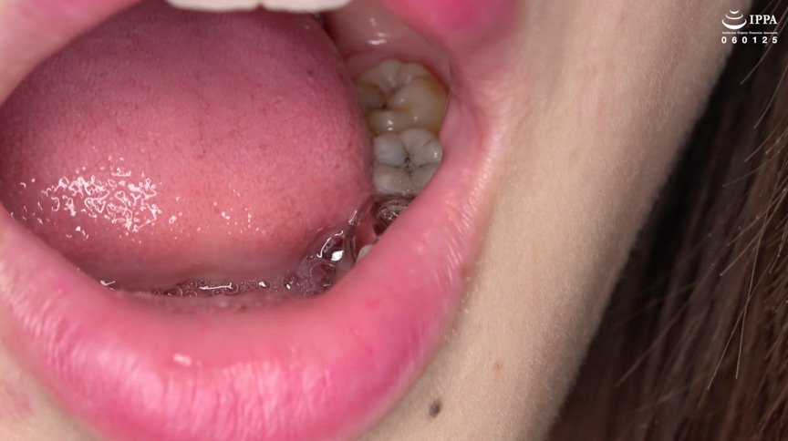 蘭々チャンの歯・銀歯・口内・のどちんこを超観察！！！ 画像11