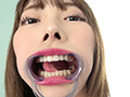 [adoa-0851] 蘭々チャンの歯・銀歯・口内・のどちんこを超観察！！！のキャプチャ画像 4