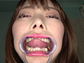 [adoa-0851] 蘭々チャンの歯・銀歯・口内・のどちんこを超観察！！！のキャプチャ画像 6