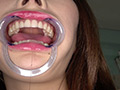 [adoa-0851] 蘭々チャンの歯・銀歯・口内・のどちんこを超観察！！！のキャプチャ画像 7