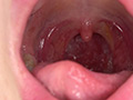 [adoa-0851] 蘭々チャンの歯・銀歯・口内・のどちんこを超観察！！！のキャプチャ画像 10