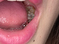 蘭々チャンの歯・銀歯・口内・のどちんこを超観察！！！ サンプル画像11