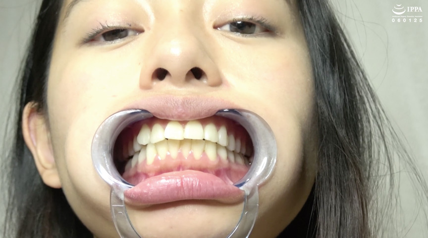 IdolLAB | adoa-0873 Emilyチャンの歯・唾・口内・のどちんこを観察