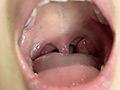 [adoa-0873] Emilyチャンの歯・唾・口内・のどちんこを観察