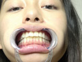 Emilyチャンの歯・唾・口内・のどちんこを観察 画像2