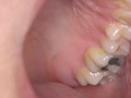 Emilyチャンの歯・唾・口内・のどちんこを観察 画像4