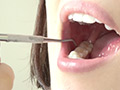 最新の宮沢ちはるチャンの口内・歯・のどちんこ観察 画像5
