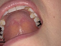 最新の宮沢ちはるチャンの口内・歯・のどちんこ観察 画像7
