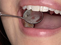 最新の宮沢ちはるチャンの口内・歯・のどちんこ観察 画像10