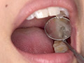 最新の宮沢ちはるチャンの口内・歯・のどちんこ観察 画像11