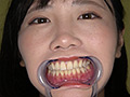 [adoa-0947]角名つむぎの超激レアな歯・口内・のどちんこ・唾観察