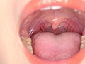 角名つむぎの超激レアな歯・口内・のどちんこ・唾観察 画像4