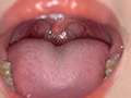 [adoa-0947] 角名つむぎの超激レアな歯・口内・のどちんこ・唾観察のキャプチャ画像 6