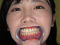 角名つむぎの超激レアな歯・口内・のどちんこ・唾観察 画像7