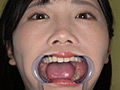 [adoa-0947] 角名つむぎの超激レアな歯・口内・のどちんこ・唾観察のキャプチャ画像 9