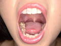 口内・歯・のどちんこ観察 画像2