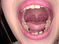 野こはるチャンの舌ベロ・歯・口内・のどちんこ観察 画像15