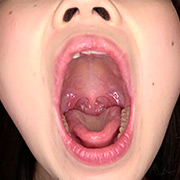 小泉ふうチャンの舌ベロ・歯・口内のどちんこ観察