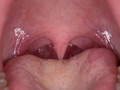 小泉ふうチャンの舌ベロ・歯・口内のどちんこ観察 画像3
