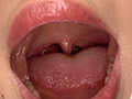 中園めいなチャンの歯・口内・のどちんこ・舌ベロ観察 サンプル画像5