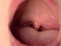 中園めいなチャンの歯・口内・のどちんこ・舌ベロ観察 画像6