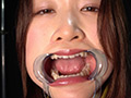 中園めいなチャンの歯・口内・のどちんこ・舌ベロ観察 画像7