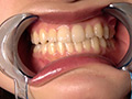 中園めいなチャンの歯・口内・のどちんこ・舌ベロ観察 画像8