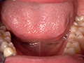 中園めいなチャンの歯・口内・のどちんこ・舌ベロ観察 画像9