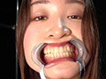 [adoa-1046] 中園めいなチャンの歯・口内・のどちんこ・舌ベロ観察のキャプチャ画像 10