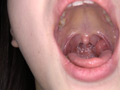 [adoa-1070] 春日えなチャンの口内・歯・舌ベロ・のどちんこ観察！！のキャプチャ画像 5