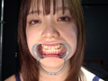 [adoa-1078] 橋本りこチャンの歯・口内・舌ベロ観察プレイ！！！のキャプチャ画像 2