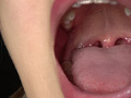 水ト麻衣奈チャンの口内・舌・歯・のどちんこを激写！ サンプル画像6