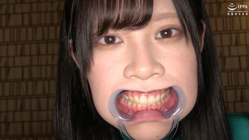 エマちゃんの歯・口内・舌ベロを観察してみた